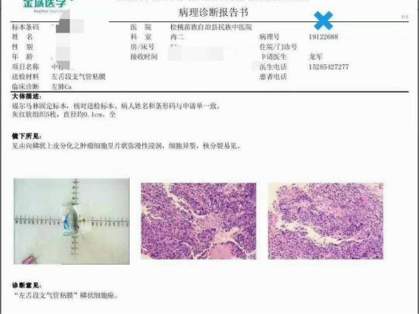 我院开展纤维支气管镜检查技术效果好